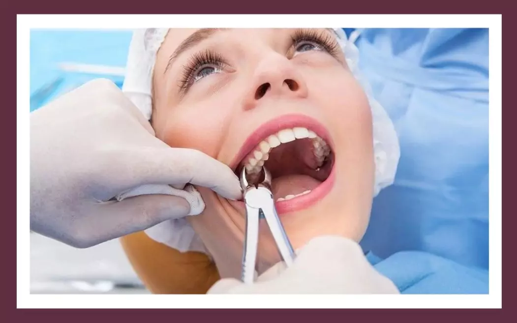 Teeth Extractions & Dental Surgeries